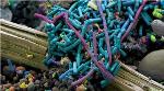 Transparent Flexible Membrane for Identifying Numerous Organisms Causing Diarrhoea or Intestinal Problems