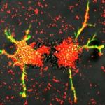 Scientists Genetically Modify White Blood Cells to Treat Degenerative Neurological Disorders