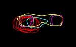 Structured Illumination Microscopy and SPA Help Study SPB Duplication in Living Yeast Cells