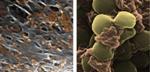Platelet-Mimicking Nanoparticles Could Effectively Deliver Drugs to Targeted Sites