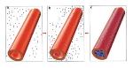Natural Nanomaterial Halloysite Holds Promise for External Medical Applications