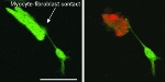 New Nanoparticle Targets and Destroys Cells That Cause Cardiac Arrhythmia