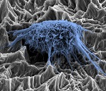 Silver Nanoparticle-Integrated Plasma Polymer Coating Prevents Bacterial Infection in Dental Implants