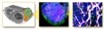 Precision Medicine Technique that Predicts the Efficacy of Nanomedicines against Different types of Cancer Developed