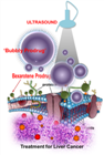 Ultrasound Ablation Therapy Pops Bexarotene Prodrug Nanobubbles Within Tumors