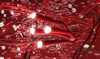 Dual-Role Nanoparticles Light Up and Treat Plaques in Arteries