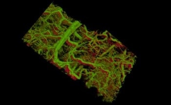 Gold Nanorods Allow Real-Time, 3D Imaging of Cells and Tissues in Living Animal
