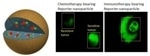Reporter Nanoparticles Help Differentiate Between Drug-Resistant and Drug-Sensitive Tumors