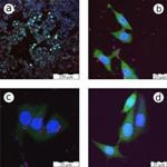 Ultrapure Silicon Nanoparticles Could Aid in Early Diagnosis and Treatment of Cancer