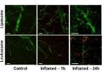 Study Shows How Nanosized Trojan Horses Could be Used for Treating Inflammatory Diseases