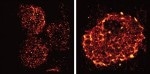 Scientists Use Super-Resolution Microscopy to Study Regulation of Immune System