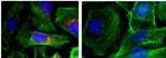 New Nanoparticle Based Treatment Platform Developed to Treat Deadly Thyroid Cancer