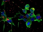 Oligochitosans can Improve Gene Therapy
