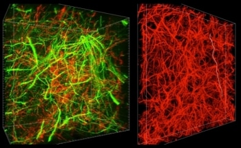 New Brain Tissue Imaging Technique Allows Researchers Take Wider View of Molecules Within Cells