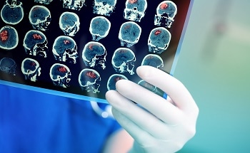New Nanoparticles Serve as Improved Contrast Agents for MRI