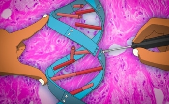 MIT Researchers Develop Gene Therapy Method with Potential to Arrest Cancer Metastasis