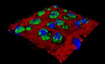 Nanoparticle Injections Hold Promise for Osteoarthritis Treatment