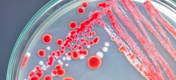 New Nanosensor can Detect Food-Based Bacteria Within One Hour
