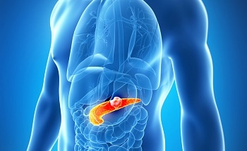 Gold Nanoparticles May Help Improve Pancreatic Cancer Treatment