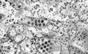 Lab Mice Successfully Vaccinated Against Dengue Fever Using Nanoparticle