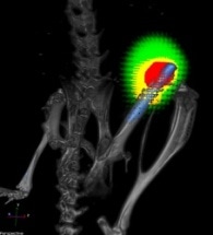 Nanofiber Coating Eliminates Infections During Joint Replacements