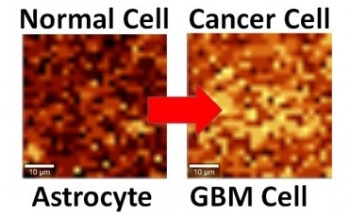 Interfacing System Can Help Differentiate Single Cancerous Cell from Normal Cell Using Graphene