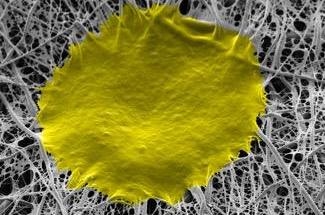 New Nanofiber Matrix to Help Produce Improved Quality Stem Cells for Disease Treatment