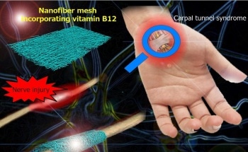 Nanofiber Mesh for Wrapping Injured Nerve and Promoting Regeneration