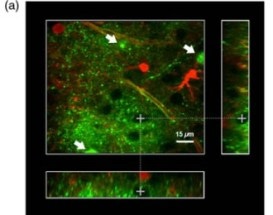 New Optical Nanosensor Enhances Accuracy of Brain Mapping