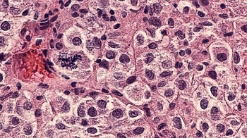 Nanoparticle Used to Deliver Drug Combination in Lab Trial Aimed at Melanoma Treatment
