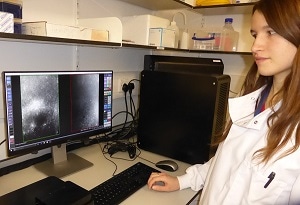 Oxford Nanoimaging Report On How The Super-Resolution Nanoimager Is Being Used At Micron Oxford, A Multidisciplinary Bioimaging Unit Applying Advanced Cellular Imaging Techniques.