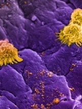 Specially-Engineered Nanoparticles Prevent Activation of the Immune System