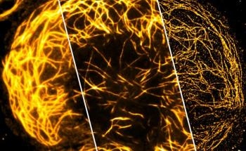 Photonic Chip for Achieving Superresolution Light Microscopy