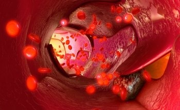 Nanolaser can Identify, Kill Metastasized Cancer Cells in Blood Stream