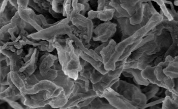 Nanodiamonds Curtail Electrochemical Deposition that Leads to Short-Circuiting of Lithium Ion Batteries