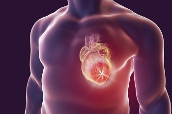 Encapsulating Stem Cells in Nanogel Could Help Treat Heart Attack