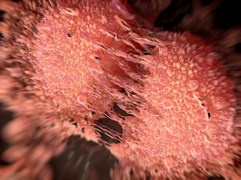 New Study Highlights Bone-Targeted Nanoparticle Treatment for Prostate Cancer