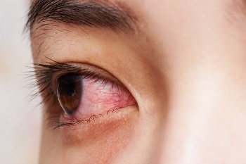 Nanosponges Could be Used to Protect Eyes from Potentially Blinding Eye Infections
