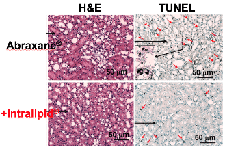 New Method for Delivering Chemotherapy Nanodrugs Reduces Side-Effects