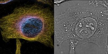 Innovative PRISM Platform Provides Unprecedented Views of Cell Interiors