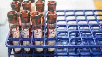 Nanoscale Blood Test Method to Speed up Early Diagnosis of Cancer