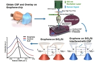 Graphene Used to Detect ALS and Other Neurodegenerative Diseases