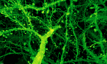 New Microscopy Approach Enables Nanoscale Imaging of Fly and Mouse Brains
