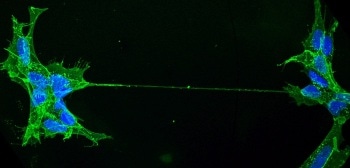 Advanced Imaging Techniques Reveal that the Structure of Tunneling Nanotubes Challenges the Concept of Cells