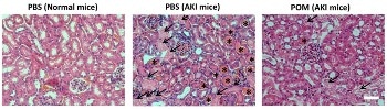 Minute Nanoclusters and Carbon Quantum Dots Exhibit Potential for Acute Kidney Injury Treatment