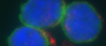 Study Shows Positive Impact of Gold Nanoparticles on Human B Lymphocytes