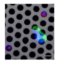 Lab on Chip to Enable Extensive Cancer Screening and Personalized Treatment