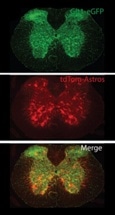 Nanotechnology Helps Repair Defective Brain Circuits in Mice