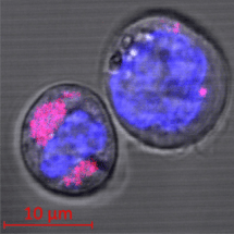 Study Examines Biological Risk Potential of Carbon Nanoparticles