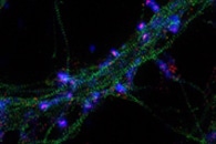 New Nanoparticle-Based Imaging Technique Captures Mechanical Properties of Living Cells